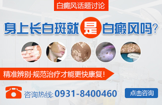 白癜风彩专题